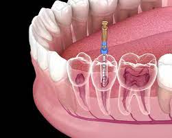 Smile Line Dental Clinic | Best Dental Clinic in Sangareddy