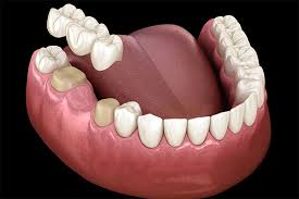 Smile Line Dental Clinic | Best Dental Clinic in Sangareddy