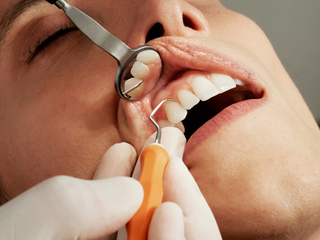 Smile Line Dental Clinic | Best Dental Clinic in Sangareddy