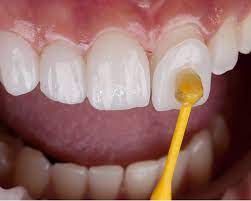 Smile Line Dental Clinic | Best Dental Clinic in Sangareddy